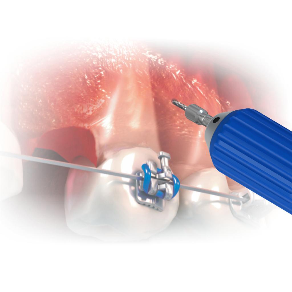 HAND DRIVER - LLAVE DE MANO MORELLI_3