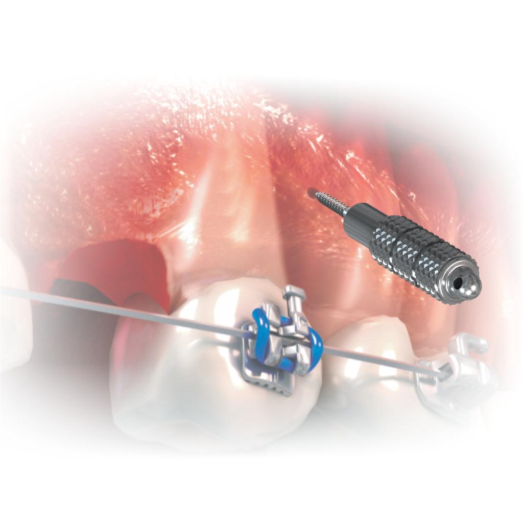 LLAVE HEXAGONAL DIGITAL MORELLI_2