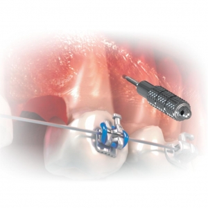 LLAVE HEXAGONAL DIGITAL MORELLI_2