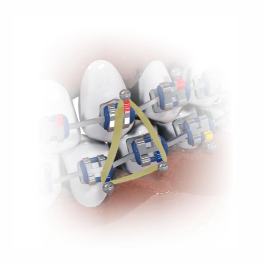ELASTICO INTRAORAL 1/8M X 1000_2