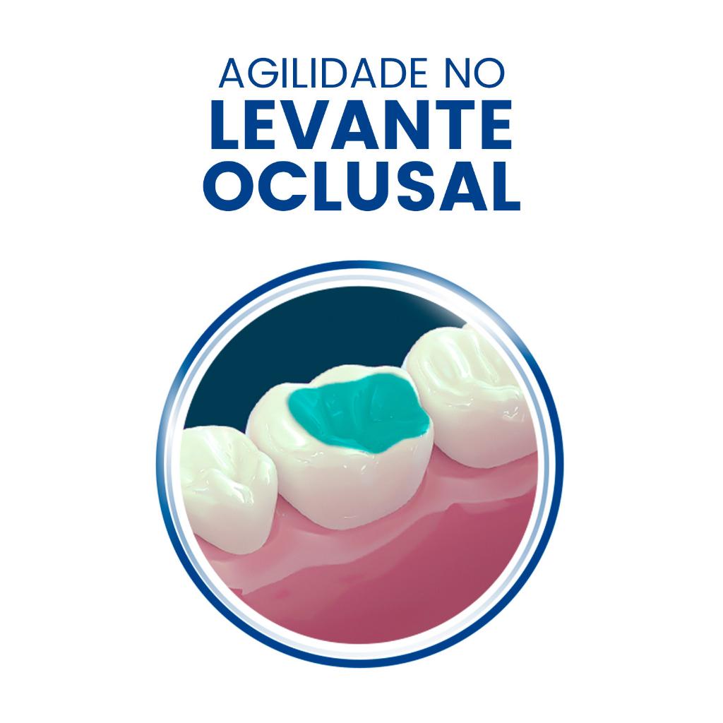 RESINA PARA DESOCLUSION OPEN BITE MORELLI_3