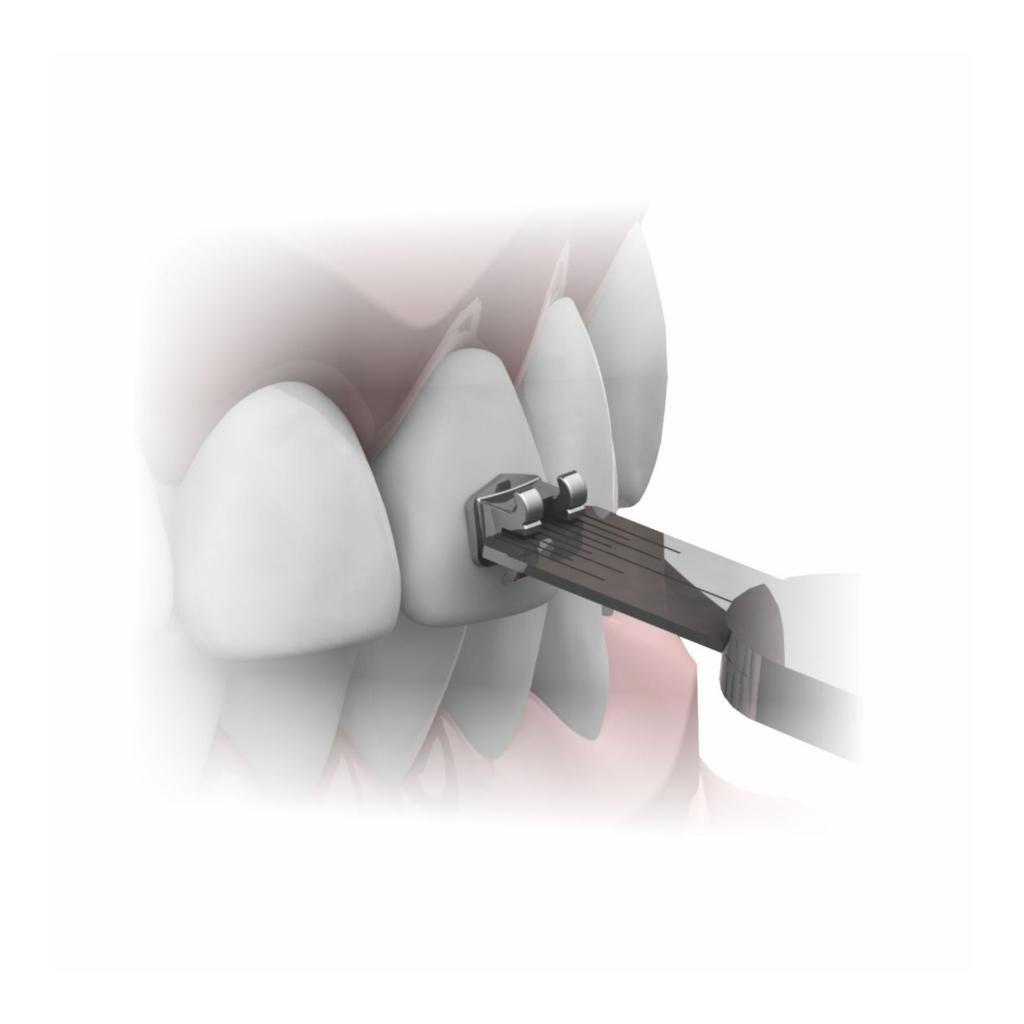 PINZA PORTA BRACKET_2