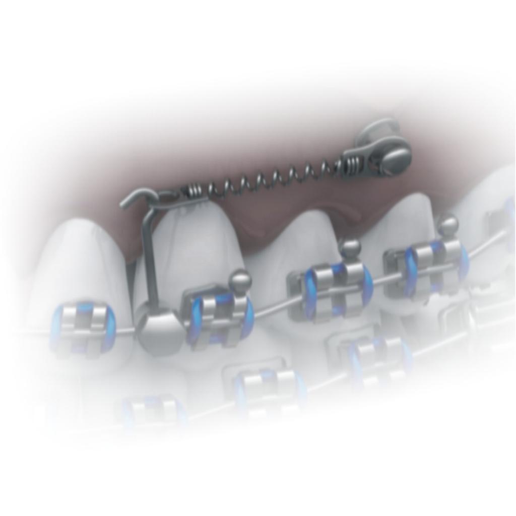 RESORTE CERRADO NiTi PARA MINI TORNILLO 7MM OJAL Ø 1.60 / Ø2.30MM MORELLI_2
