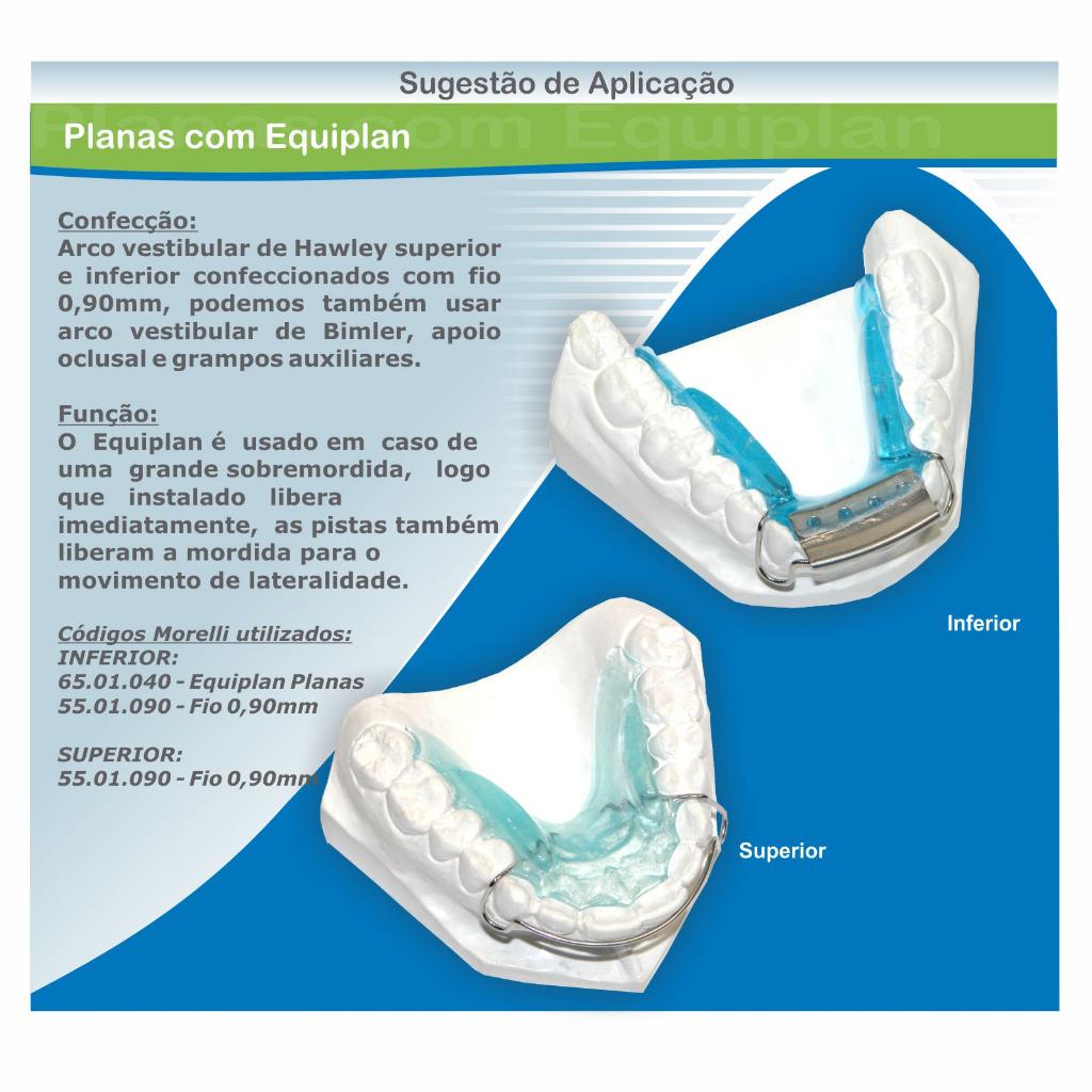 EQUIPLAN_2