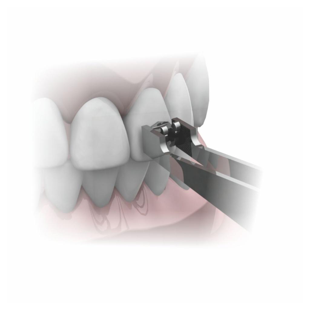 PINZA PORTA BRACKET_3