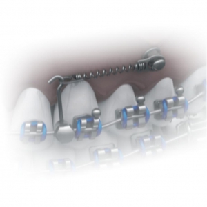 RESORTE CERRADO NiTi PARA MINI TORNILLO  12MM OJAL Ø 1.60 / Ø2.30MM MORELLI_2