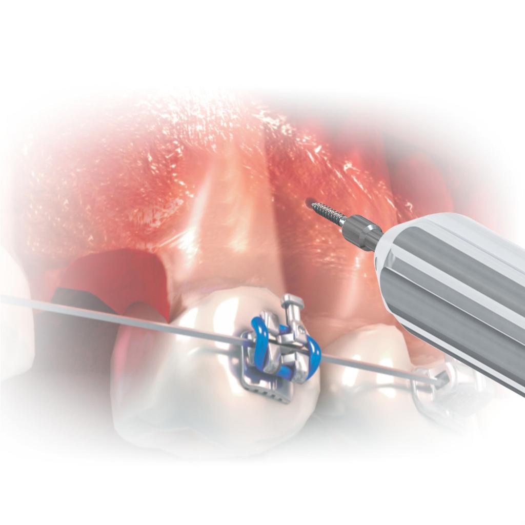EXTENSIÓN LLAVE HEXAGONAL TALLO CORTO MORELLI_2