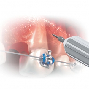 EXTENSIÓN LLAVE HEXAGONAL TALLO CORTO MORELLI_2