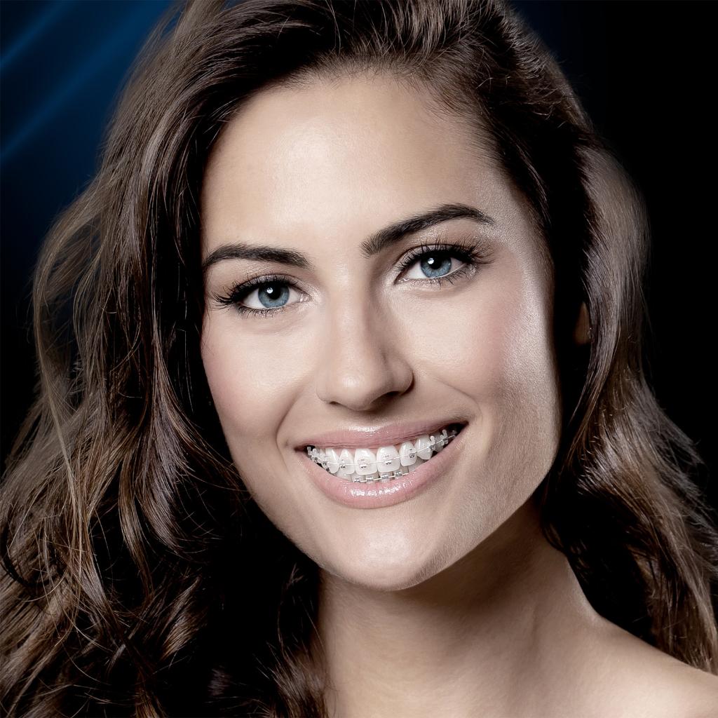 BRACKET REPARACIÓN ROTH CERAMIC AUTOLIGADO SLI .022 12 REPUESTO_3