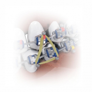 ELASTICO INTRAORAL 3/8M X1000_2